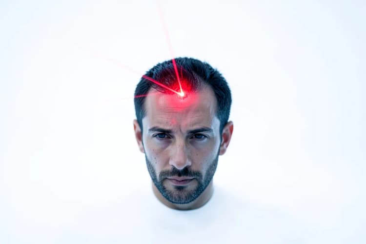 Cabeça de homem com laser vermelho focado no couro cabeludo, em fundo branco.