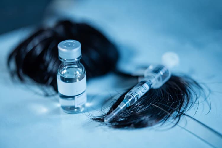 Um frasco de medicamento com conta-gotas e uma seringa ao lado de um couro cabeludo com poucos fios de cabelo.