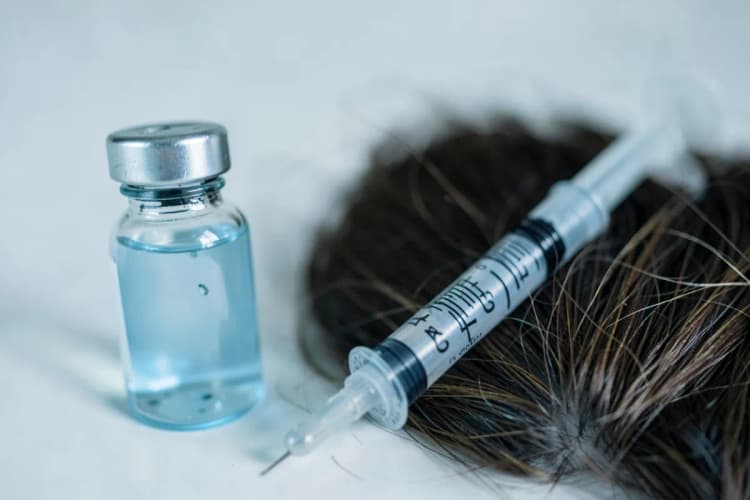 Um frasco de medicamento com conta-gotas e uma seringa ao lado de um couro cabeludo com poucos fios de cabelo.