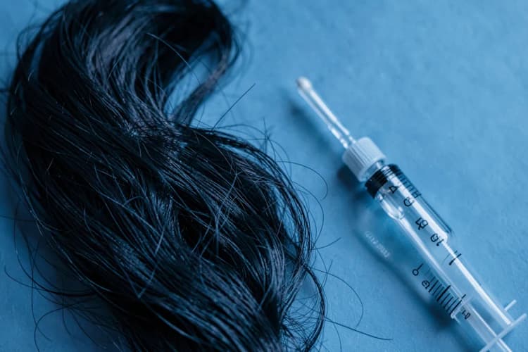 Um frasco de medicamento com conta-gotas e uma seringa ao lado de um couro cabeludo com poucos fios de cabelo.